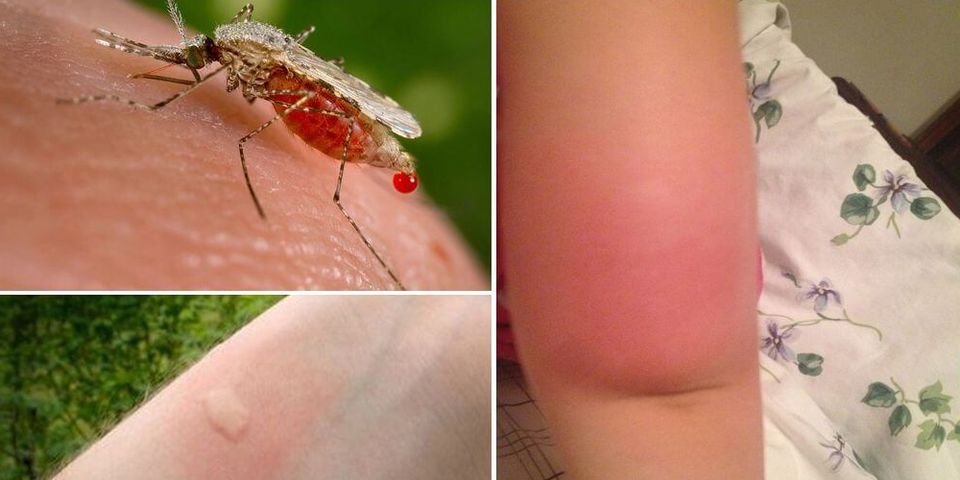 Иностранные медикаменты могут не лечить, а калечить наших моряков