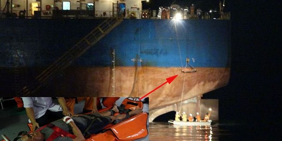 Травма позвоночника, груди и раздроблена рука: в машинном отделении что-то пошло не так